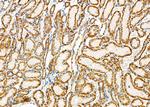 SLC24A3 Polyclonal Antibody