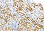 SLC5A6 Polyclonal Antibody