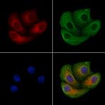 SNX4 Polyclonal Antibody