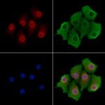 SRSF11 Polyclonal Antibody