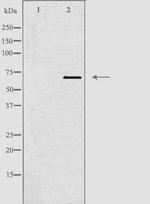 TBX18 Polyclonal Antibody