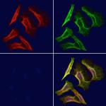 CD1E Antibody in Immunocytochemistry (ICC/IF)