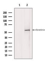 CD1E Antibody in Western Blot (WB)