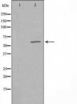 CCT6A Polyclonal Antibody
