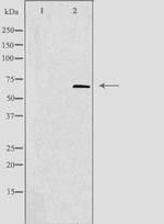 TIGD1 Antibody in Western Blot (WB)