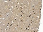 TAF3 Polyclonal Antibody