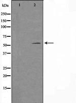 TSEN54 Polyclonal Antibody