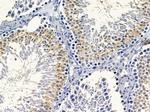 PEAK1 Antibody in Immunohistochemistry (Paraffin) (IHC (P))