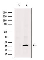 UBE2T Polyclonal Antibody