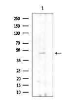 UEVLD Polyclonal Antibody