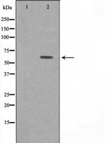 ATP6V1B1 Polyclonal Antibody