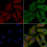 VPS26B Polyclonal Antibody