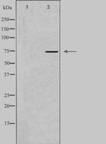 NSF Antibody in Western Blot (WB)
