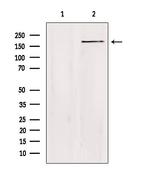 ZC3H13 Polyclonal Antibody