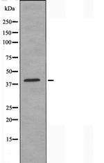 ZC3H8 Polyclonal Antibody