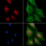 ZNF420 Polyclonal Antibody