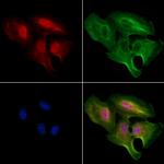 ZNF460 Antibody in Immunocytochemistry (ICC/IF)