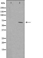 ZNF460 Antibody in Western Blot (WB)