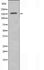 ZNF592 Antibody in Western Blot (WB)