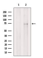 ZIP4 Polyclonal Antibody