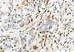 PTGR2 Polyclonal Antibody