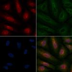 RAD51C Polyclonal Antibody