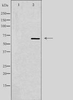 ALS Polyclonal Antibody