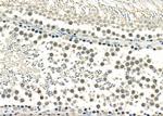 RALY Antibody in Immunohistochemistry (Paraffin) (IHC (P))