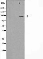 A20A1 Polyclonal Antibody