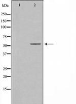 CREB3L2 Antibody in Western Blot (WB)