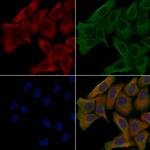 PPFIBP1 Polyclonal Antibody