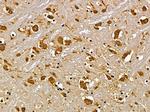 SLC30A9 Antibody in Immunohistochemistry (Paraffin) (IHC (P))