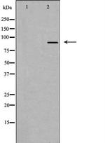 DGKB Polyclonal Antibody
