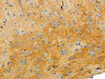 Cytochrome C1 Polyclonal Antibody
