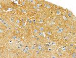 Cytochrome C1 Antibody in Immunohistochemistry (Paraffin) (IHC (P))