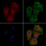 IL15RA Polyclonal Antibody