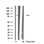MX2 Antibody in Western Blot (WB)