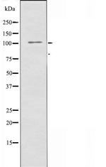 SNIP Antibody in Western Blot (WB)