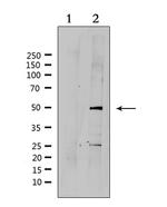 SUV39H2 Polyclonal Antibody