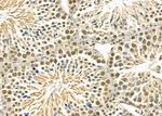 TAIP2 Antibody in Immunohistochemistry (Paraffin) (IHC (P))