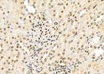 TAIP2 Antibody in Immunohistochemistry (Paraffin) (IHC (P))
