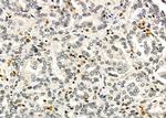 TAIP2 Antibody in Immunohistochemistry (Paraffin) (IHC (P))