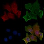 CNNM2 Polyclonal Antibody