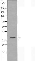 TMEM101 Antibody in Western Blot (WB)
