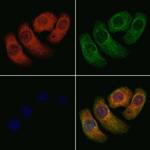 CYP4A11/CYP4A22 Antibody in Immunocytochemistry (ICC/IF)