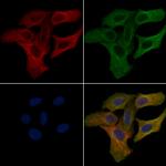 CYP4F11 Polyclonal Antibody