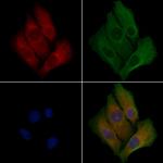 CYP20A1 Polyclonal Antibody