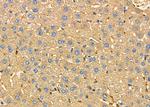 CYP20A1 Antibody in Immunohistochemistry (Paraffin) (IHC (P))
