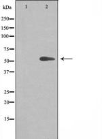 CYP20A1 Antibody in Western Blot (WB)