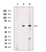MAGEC2 Antibody in Western Blot (WB)